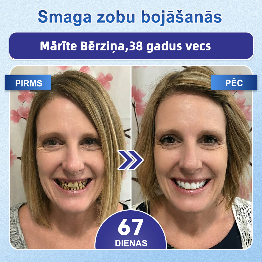 𝐆𝐚𝐫𝐚𝐠𝐞𝐋𝐢𝐧𝐞® 🛒 𝐓𝐢𝐝𝐞𝐠𝐥𝐮𝐬𝐢𝐛 ā𝐭𝐫𝐢 šķī𝐬𝐭𝐨š𝐚𝐬 𝐦𝐮𝐭𝐞𝐬 𝐩𝐥ē𝐤𝐬𝐧ī𝐭𝐞𝐬 𝐳𝐨𝐛𝐮 𝐮𝐧 𝐬𝐦𝐚𝐠𝐚𝐧𝐮 𝐚𝐭𝐣𝐚𝐮𝐧𝐨š𝐚𝐧𝐚𝐢 ✨ (𝐀𝐭𝐛𝐚𝐥𝐬𝐭𝐚 𝐳𝐨𝐛𝐮 𝐚𝐭𝐣𝐚𝐮𝐧𝐨š𝐚𝐧𝐮 𝐮𝐧 𝐩𝐚𝐥ī𝐝𝐳 𝐦𝐚𝐳𝐢𝐧ā𝐭 𝐬𝐦𝐚𝐠𝐚𝐧𝐮 𝐝𝐢𝐬𝐤𝐨𝐦𝐟𝐨𝐫𝐭𝐮 𝐮𝐧 𝐜𝐢𝐭𝐚𝐬 𝐛𝐢𝐞žā𝐤ā𝐬 𝐦𝐮𝐭𝐞𝐬 𝐝𝐨𝐛𝐮𝐦𝐚 𝐩𝐫𝐨𝐛𝐥ē𝐦𝐚𝐬)