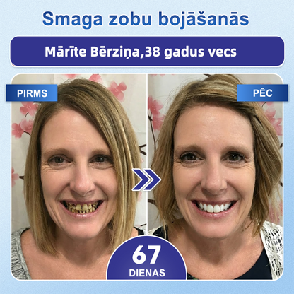 𝐆𝐚𝐫𝐚𝐠𝐞𝐋𝐢𝐧𝐞® 🛒 𝐓𝐢𝐝𝐞𝐠𝐥𝐮𝐬𝐢𝐛 ā𝐭𝐫𝐢 šķī𝐬𝐭𝐨š𝐚𝐬 𝐦𝐮𝐭𝐞𝐬 𝐩𝐥ē𝐤𝐬𝐧ī𝐭𝐞𝐬 𝐳𝐨𝐛𝐮 𝐮𝐧 𝐬𝐦𝐚𝐠𝐚𝐧𝐮 𝐚𝐭𝐣𝐚𝐮𝐧𝐨š𝐚𝐧𝐚𝐢 ✨ (𝐀𝐭𝐛𝐚𝐥𝐬𝐭𝐚 𝐳𝐨𝐛𝐮 𝐚𝐭𝐣𝐚𝐮𝐧𝐨š𝐚𝐧𝐮 𝐮𝐧 𝐩𝐚𝐥ī𝐝𝐳 𝐦𝐚𝐳𝐢𝐧ā𝐭 𝐬𝐦𝐚𝐠𝐚𝐧𝐮 𝐝𝐢𝐬𝐤𝐨𝐦𝐟𝐨𝐫𝐭𝐮 𝐮𝐧 𝐜𝐢𝐭𝐚𝐬 𝐛𝐢𝐞žā𝐤ā𝐬 𝐦𝐮𝐭𝐞𝐬 𝐝𝐨𝐛𝐮𝐦𝐚 𝐩𝐫𝐨𝐛𝐥ē𝐦𝐚𝐬)