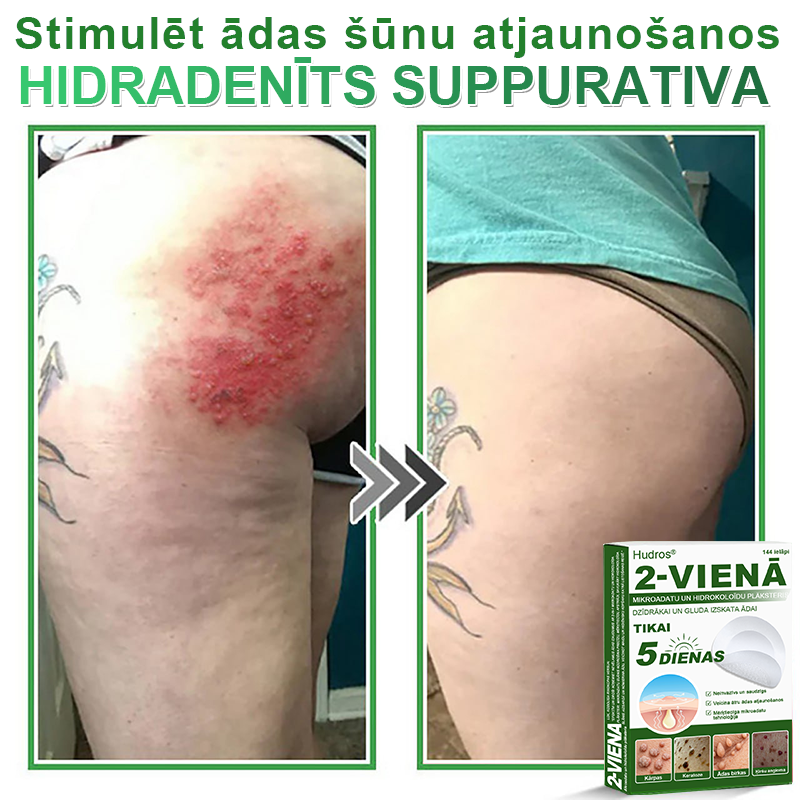 👍 𝐇𝐮𝐝𝐫𝐨𝐬® 𝟐-𝐯-𝟏 𝐡𝐢𝐝𝐫𝐨𝐤𝐨𝐥𝐨ī𝐝𝐢 𝐩𝐥ā𝐤𝐬𝐭𝐞𝐫𝐢 𝐚𝐫 𝐦𝐢𝐤𝐫𝐨𝐚𝐝𝐚𝐭𝐢ņā𝐦 | Ī𝐩𝐚š𝐢 𝐢𝐳𝐬𝐭𝐫ā𝐝ā𝐭𝐢 𝐢𝐳𝐯𝐢𝐫𝐳ī𝐭𝐮 𝐝𝐳𝐢𝐦𝐮𝐦𝐳ī𝐦𝐣𝐮, 𝐚𝐤𝐧𝐞𝐬, 𝐩𝐥𝐚𝐤𝐚𝐧𝐨 𝐤ā𝐫𝐩𝐮 𝐮𝐧 ā𝐝𝐚𝐬 𝐯𝐞𝐢𝐝𝐨𝐣𝐮𝐦𝐮 𝐧𝐨ņ𝐞𝐦š𝐚𝐧𝐚𝐢 | 𝟏𝟒𝟒 𝐠𝐚𝐛𝐚𝐥𝐮 𝐢𝐞𝐩𝐚𝐤𝐨𝐣𝐮𝐦𝐬