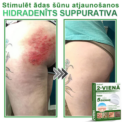 👍 𝐇𝐮𝐝𝐫𝐨𝐬® 𝟐-𝐯-𝟏 𝐡𝐢𝐝𝐫𝐨𝐤𝐨𝐥𝐨ī𝐝𝐢 𝐩𝐥ā𝐤𝐬𝐭𝐞𝐫𝐢 𝐚𝐫 𝐦𝐢𝐤𝐫𝐨𝐚𝐝𝐚𝐭𝐢ņā𝐦 | Ī𝐩𝐚š𝐢 𝐢𝐳𝐬𝐭𝐫ā𝐝ā𝐭𝐢 𝐢𝐳𝐯𝐢𝐫𝐳ī𝐭𝐮 𝐝𝐳𝐢𝐦𝐮𝐦𝐳ī𝐦𝐣𝐮, 𝐚𝐤𝐧𝐞𝐬, 𝐩𝐥𝐚𝐤𝐚𝐧𝐨 𝐤ā𝐫𝐩𝐮 𝐮𝐧 ā𝐝𝐚𝐬 𝐯𝐞𝐢𝐝𝐨𝐣𝐮𝐦𝐮 𝐧𝐨ņ𝐞𝐦š𝐚𝐧𝐚𝐢 | 𝟏𝟒𝟒 𝐠𝐚𝐛𝐚𝐥𝐮 𝐢𝐞𝐩𝐚𝐤𝐨𝐣𝐮𝐦𝐬