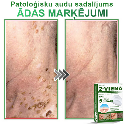 👍 𝐇𝐮𝐝𝐫𝐨𝐬® 𝟐-𝐯-𝟏 𝐡𝐢𝐝𝐫𝐨𝐤𝐨𝐥𝐨ī𝐝𝐢 𝐩𝐥ā𝐤𝐬𝐭𝐞𝐫𝐢 𝐚𝐫 𝐦𝐢𝐤𝐫𝐨𝐚𝐝𝐚𝐭𝐢ņā𝐦 | Ī𝐩𝐚š𝐢 𝐢𝐳𝐬𝐭𝐫ā𝐝ā𝐭𝐢 𝐢𝐳𝐯𝐢𝐫𝐳ī𝐭𝐮 𝐝𝐳𝐢𝐦𝐮𝐦𝐳ī𝐦𝐣𝐮, 𝐚𝐤𝐧𝐞𝐬, 𝐩𝐥𝐚𝐤𝐚𝐧𝐨 𝐤ā𝐫𝐩𝐮 𝐮𝐧 ā𝐝𝐚𝐬 𝐯𝐞𝐢𝐝𝐨𝐣𝐮𝐦𝐮 𝐧𝐨ņ𝐞𝐦š𝐚𝐧𝐚𝐢 | 𝟏𝟒𝟒 𝐠𝐚𝐛𝐚𝐥𝐮 𝐢𝐞𝐩𝐚𝐤𝐨𝐣𝐮𝐦𝐬