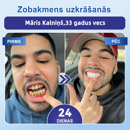 𝐆𝐚𝐫𝐚𝐠𝐞𝐋𝐢𝐧𝐞® 🛒 𝐓𝐢𝐝𝐞𝐠𝐥𝐮𝐬𝐢𝐛 ā𝐭𝐫𝐢 šķī𝐬𝐭𝐨š𝐚𝐬 𝐦𝐮𝐭𝐞𝐬 𝐩𝐥ē𝐤𝐬𝐧ī𝐭𝐞𝐬 𝐳𝐨𝐛𝐮 𝐮𝐧 𝐬𝐦𝐚𝐠𝐚𝐧𝐮 𝐚𝐭𝐣𝐚𝐮𝐧𝐨š𝐚𝐧𝐚𝐢 ✨ (𝐀𝐭𝐛𝐚𝐥𝐬𝐭𝐚 𝐳𝐨𝐛𝐮 𝐚𝐭𝐣𝐚𝐮𝐧𝐨š𝐚𝐧𝐮 𝐮𝐧 𝐩𝐚𝐥ī𝐝𝐳 𝐦𝐚𝐳𝐢𝐧ā𝐭 𝐬𝐦𝐚𝐠𝐚𝐧𝐮 𝐝𝐢𝐬𝐤𝐨𝐦𝐟𝐨𝐫𝐭𝐮 𝐮𝐧 𝐜𝐢𝐭𝐚𝐬 𝐛𝐢𝐞žā𝐤ā𝐬 𝐦𝐮𝐭𝐞𝐬 𝐝𝐨𝐛𝐮𝐦𝐚 𝐩𝐫𝐨𝐛𝐥ē𝐦𝐚𝐬)
