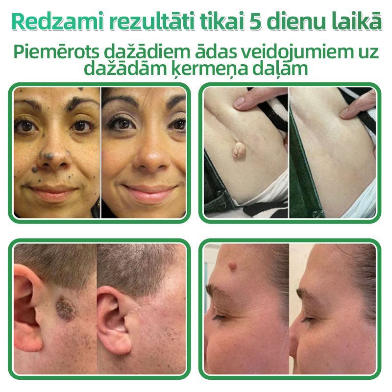 👍 𝐇𝐮𝐝𝐫𝐨𝐬® 𝟐-𝐯-𝟏 𝐡𝐢𝐝𝐫𝐨𝐤𝐨𝐥𝐨ī𝐝𝐢 𝐩𝐥ā𝐤𝐬𝐭𝐞𝐫𝐢 𝐚𝐫 𝐦𝐢𝐤𝐫𝐨𝐚𝐝𝐚𝐭𝐢ņā𝐦 | Ī𝐩𝐚š𝐢 𝐢𝐳𝐬𝐭𝐫ā𝐝ā𝐭𝐢 𝐢𝐳𝐯𝐢𝐫𝐳ī𝐭𝐮 𝐝𝐳𝐢𝐦𝐮𝐦𝐳ī𝐦𝐣𝐮, 𝐚𝐤𝐧𝐞𝐬, 𝐩𝐥𝐚𝐤𝐚𝐧𝐨 𝐤ā𝐫𝐩𝐮 𝐮𝐧 ā𝐝𝐚𝐬 𝐯𝐞𝐢𝐝𝐨𝐣𝐮𝐦𝐮 𝐧𝐨ņ𝐞𝐦š𝐚𝐧𝐚𝐢 | 𝟏𝟒𝟒 𝐠𝐚𝐛𝐚𝐥𝐮 𝐢𝐞𝐩𝐚𝐤𝐨𝐣𝐮𝐦𝐬