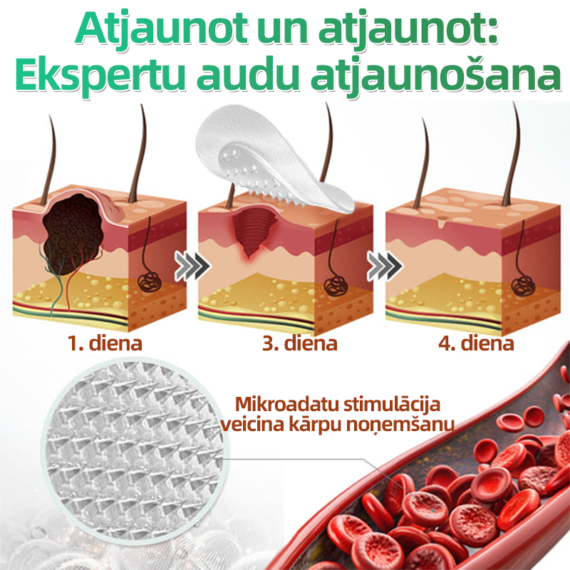 👍 𝐇𝐮𝐝𝐫𝐨𝐬® 𝟐-𝐯-𝟏 𝐡𝐢𝐝𝐫𝐨𝐤𝐨𝐥𝐨ī𝐝𝐢 𝐩𝐥ā𝐤𝐬𝐭𝐞𝐫𝐢 𝐚𝐫 𝐦𝐢𝐤𝐫𝐨𝐚𝐝𝐚𝐭𝐢ņā𝐦 | Ī𝐩𝐚š𝐢 𝐢𝐳𝐬𝐭𝐫ā𝐝ā𝐭𝐢 𝐢𝐳𝐯𝐢𝐫𝐳ī𝐭𝐮 𝐝𝐳𝐢𝐦𝐮𝐦𝐳ī𝐦𝐣𝐮, 𝐚𝐤𝐧𝐞𝐬, 𝐩𝐥𝐚𝐤𝐚𝐧𝐨 𝐤ā𝐫𝐩𝐮 𝐮𝐧 ā𝐝𝐚𝐬 𝐯𝐞𝐢𝐝𝐨𝐣𝐮𝐦𝐮 𝐧𝐨ņ𝐞𝐦š𝐚𝐧𝐚𝐢 | 𝟏𝟒𝟒 𝐠𝐚𝐛𝐚𝐥𝐮 𝐢𝐞𝐩𝐚𝐤𝐨𝐣𝐮𝐦𝐬