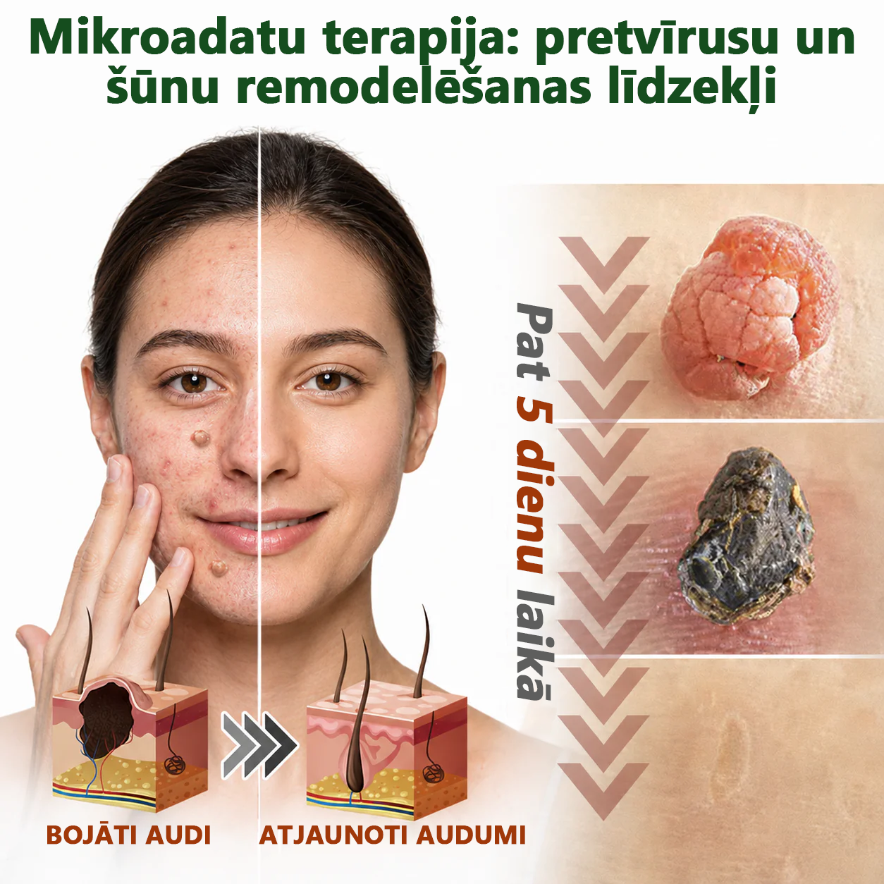 👍 𝐇𝐮𝐝𝐫𝐨𝐬® 𝟐-𝐯-𝟏 𝐡𝐢𝐝𝐫𝐨𝐤𝐨𝐥𝐨ī𝐝𝐢 𝐩𝐥ā𝐤𝐬𝐭𝐞𝐫𝐢 𝐚𝐫 𝐦𝐢𝐤𝐫𝐨𝐚𝐝𝐚𝐭𝐢ņā𝐦 | Ī𝐩𝐚š𝐢 𝐢𝐳𝐬𝐭𝐫ā𝐝ā𝐭𝐢 𝐢𝐳𝐯𝐢𝐫𝐳ī𝐭𝐮 𝐝𝐳𝐢𝐦𝐮𝐦𝐳ī𝐦𝐣𝐮, 𝐚𝐤𝐧𝐞𝐬, 𝐩𝐥𝐚𝐤𝐚𝐧𝐨 𝐤ā𝐫𝐩𝐮 𝐮𝐧 ā𝐝𝐚𝐬 𝐯𝐞𝐢𝐝𝐨𝐣𝐮𝐦𝐮 𝐧𝐨ņ𝐞𝐦š𝐚𝐧𝐚𝐢 | 𝟏𝟒𝟒 𝐠𝐚𝐛𝐚𝐥𝐮 𝐢𝐞𝐩𝐚𝐤𝐨𝐣𝐮𝐦𝐬