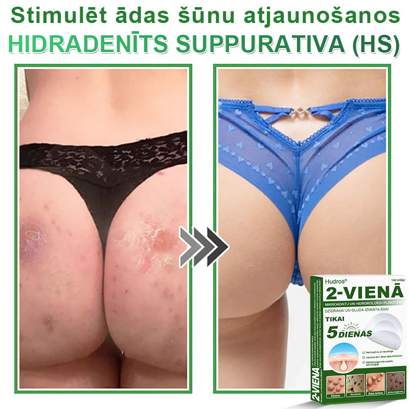 👍 𝐇𝐮𝐝𝐫𝐨𝐬® 𝟐-𝐯-𝟏 𝐡𝐢𝐝𝐫𝐨𝐤𝐨𝐥𝐨ī𝐝𝐢 𝐩𝐥ā𝐤𝐬𝐭𝐞𝐫𝐢 𝐚𝐫 𝐦𝐢𝐤𝐫𝐨𝐚𝐝𝐚𝐭𝐢ņā𝐦 | Ī𝐩𝐚š𝐢 𝐢𝐳𝐬𝐭𝐫ā𝐝ā𝐭𝐢 𝐢𝐳𝐯𝐢𝐫𝐳ī𝐭𝐮 𝐝𝐳𝐢𝐦𝐮𝐦𝐳ī𝐦𝐣𝐮, 𝐚𝐤𝐧𝐞𝐬, 𝐩𝐥𝐚𝐤𝐚𝐧𝐨 𝐤ā𝐫𝐩𝐮 𝐮𝐧 ā𝐝𝐚𝐬 𝐯𝐞𝐢𝐝𝐨𝐣𝐮𝐦𝐮 𝐧𝐨ņ𝐞𝐦š𝐚𝐧𝐚𝐢 | 𝟏𝟒𝟒 𝐠𝐚𝐛𝐚𝐥𝐮 𝐢𝐞𝐩𝐚𝐤𝐨𝐣𝐮𝐦𝐬