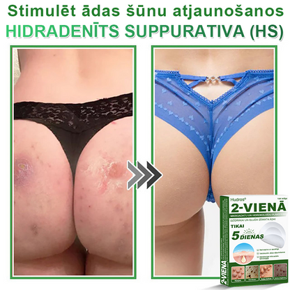 👍 𝐇𝐮𝐝𝐫𝐨𝐬® 𝟐-𝐯-𝟏 𝐡𝐢𝐝𝐫𝐨𝐤𝐨𝐥𝐨ī𝐝𝐢 𝐩𝐥ā𝐤𝐬𝐭𝐞𝐫𝐢 𝐚𝐫 𝐦𝐢𝐤𝐫𝐨𝐚𝐝𝐚𝐭𝐢ņā𝐦 | Ī𝐩𝐚š𝐢 𝐢𝐳𝐬𝐭𝐫ā𝐝ā𝐭𝐢 𝐢𝐳𝐯𝐢𝐫𝐳ī𝐭𝐮 𝐝𝐳𝐢𝐦𝐮𝐦𝐳ī𝐦𝐣𝐮, 𝐚𝐤𝐧𝐞𝐬, 𝐩𝐥𝐚𝐤𝐚𝐧𝐨 𝐤ā𝐫𝐩𝐮 𝐮𝐧 ā𝐝𝐚𝐬 𝐯𝐞𝐢𝐝𝐨𝐣𝐮𝐦𝐮 𝐧𝐨ņ𝐞𝐦š𝐚𝐧𝐚𝐢 | 𝟏𝟒𝟒 𝐠𝐚𝐛𝐚𝐥𝐮 𝐢𝐞𝐩𝐚𝐤𝐨𝐣𝐮𝐦𝐬