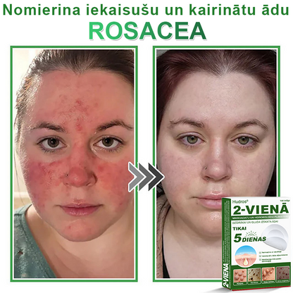 👍 𝐇𝐮𝐝𝐫𝐨𝐬® 𝟐-𝐯-𝟏 𝐡𝐢𝐝𝐫𝐨𝐤𝐨𝐥𝐨ī𝐝𝐢 𝐩𝐥ā𝐤𝐬𝐭𝐞𝐫𝐢 𝐚𝐫 𝐦𝐢𝐤𝐫𝐨𝐚𝐝𝐚𝐭𝐢ņā𝐦 | Ī𝐩𝐚š𝐢 𝐢𝐳𝐬𝐭𝐫ā𝐝ā𝐭𝐢 𝐢𝐳𝐯𝐢𝐫𝐳ī𝐭𝐮 𝐝𝐳𝐢𝐦𝐮𝐦𝐳ī𝐦𝐣𝐮, 𝐚𝐤𝐧𝐞𝐬, 𝐩𝐥𝐚𝐤𝐚𝐧𝐨 𝐤ā𝐫𝐩𝐮 𝐮𝐧 ā𝐝𝐚𝐬 𝐯𝐞𝐢𝐝𝐨𝐣𝐮𝐦𝐮 𝐧𝐨ņ𝐞𝐦š𝐚𝐧𝐚𝐢 | 𝟏𝟒𝟒 𝐠𝐚𝐛𝐚𝐥𝐮 𝐢𝐞𝐩𝐚𝐤𝐨𝐣𝐮𝐦𝐬