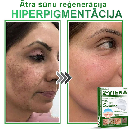 👍 𝐇𝐮𝐝𝐫𝐨𝐬® 𝟐-𝐯-𝟏 𝐡𝐢𝐝𝐫𝐨𝐤𝐨𝐥𝐨ī𝐝𝐢 𝐩𝐥ā𝐤𝐬𝐭𝐞𝐫𝐢 𝐚𝐫 𝐦𝐢𝐤𝐫𝐨𝐚𝐝𝐚𝐭𝐢ņā𝐦 | Ī𝐩𝐚š𝐢 𝐢𝐳𝐬𝐭𝐫ā𝐝ā𝐭𝐢 𝐢𝐳𝐯𝐢𝐫𝐳ī𝐭𝐮 𝐝𝐳𝐢𝐦𝐮𝐦𝐳ī𝐦𝐣𝐮, 𝐚𝐤𝐧𝐞𝐬, 𝐩𝐥𝐚𝐤𝐚𝐧𝐨 𝐤ā𝐫𝐩𝐮 𝐮𝐧 ā𝐝𝐚𝐬 𝐯𝐞𝐢𝐝𝐨𝐣𝐮𝐦𝐮 𝐧𝐨ņ𝐞𝐦š𝐚𝐧𝐚𝐢 | 𝟏𝟒𝟒 𝐠𝐚𝐛𝐚𝐥𝐮 𝐢𝐞𝐩𝐚𝐤𝐨𝐣𝐮𝐦𝐬