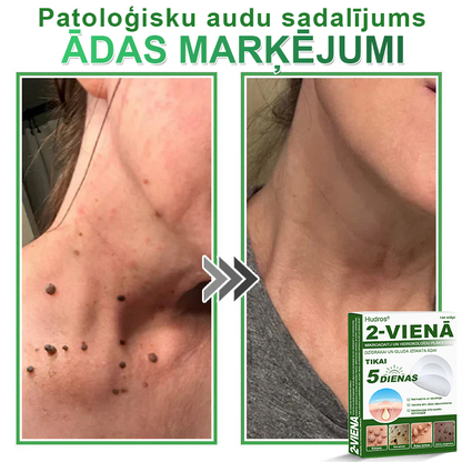 👍 𝐇𝐮𝐝𝐫𝐨𝐬® 𝟐-𝐯-𝟏 𝐡𝐢𝐝𝐫𝐨𝐤𝐨𝐥𝐨ī𝐝𝐢 𝐩𝐥ā𝐤𝐬𝐭𝐞𝐫𝐢 𝐚𝐫 𝐦𝐢𝐤𝐫𝐨𝐚𝐝𝐚𝐭𝐢ņā𝐦 | Ī𝐩𝐚š𝐢 𝐢𝐳𝐬𝐭𝐫ā𝐝ā𝐭𝐢 𝐢𝐳𝐯𝐢𝐫𝐳ī𝐭𝐮 𝐝𝐳𝐢𝐦𝐮𝐦𝐳ī𝐦𝐣𝐮, 𝐚𝐤𝐧𝐞𝐬, 𝐩𝐥𝐚𝐤𝐚𝐧𝐨 𝐤ā𝐫𝐩𝐮 𝐮𝐧 ā𝐝𝐚𝐬 𝐯𝐞𝐢𝐝𝐨𝐣𝐮𝐦𝐮 𝐧𝐨ņ𝐞𝐦š𝐚𝐧𝐚𝐢 | 𝟏𝟒𝟒 𝐠𝐚𝐛𝐚𝐥𝐮 𝐢𝐞𝐩𝐚𝐤𝐨𝐣𝐮𝐦𝐬