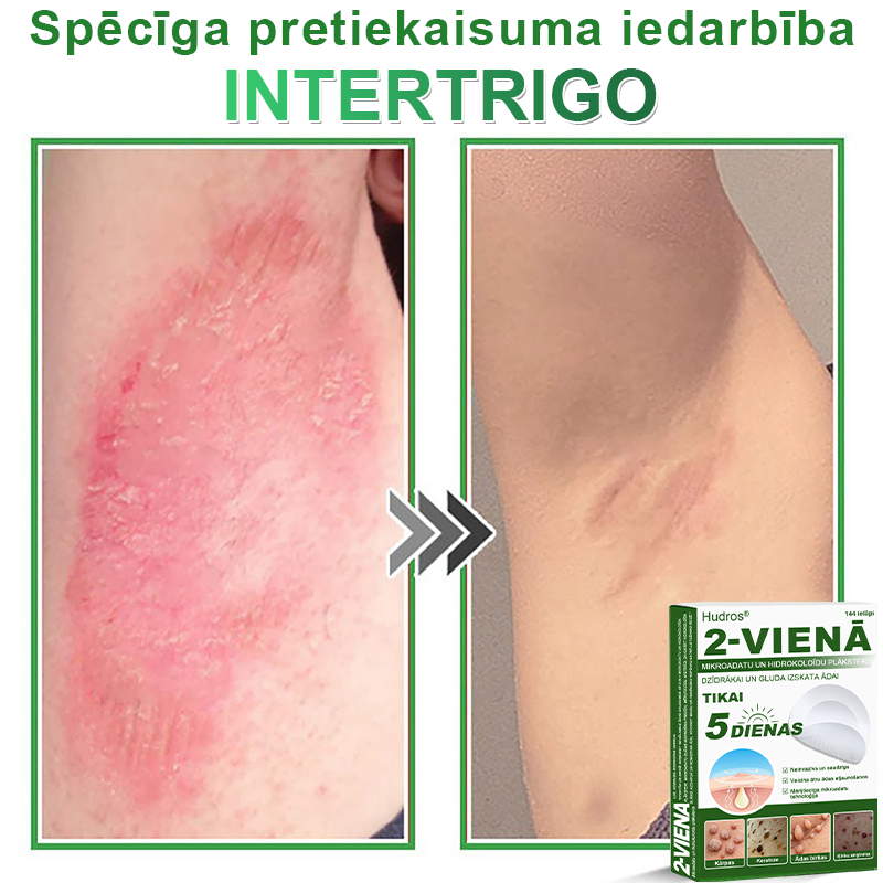 👍 𝐇𝐮𝐝𝐫𝐨𝐬® 𝟐-𝐯-𝟏 𝐡𝐢𝐝𝐫𝐨𝐤𝐨𝐥𝐨ī𝐝𝐢 𝐩𝐥ā𝐤𝐬𝐭𝐞𝐫𝐢 𝐚𝐫 𝐦𝐢𝐤𝐫𝐨𝐚𝐝𝐚𝐭𝐢ņā𝐦 | Ī𝐩𝐚š𝐢 𝐢𝐳𝐬𝐭𝐫ā𝐝ā𝐭𝐢 𝐢𝐳𝐯𝐢𝐫𝐳ī𝐭𝐮 𝐝𝐳𝐢𝐦𝐮𝐦𝐳ī𝐦𝐣𝐮, 𝐚𝐤𝐧𝐞𝐬, 𝐩𝐥𝐚𝐤𝐚𝐧𝐨 𝐤ā𝐫𝐩𝐮 𝐮𝐧 ā𝐝𝐚𝐬 𝐯𝐞𝐢𝐝𝐨𝐣𝐮𝐦𝐮 𝐧𝐨ņ𝐞𝐦š𝐚𝐧𝐚𝐢 | 𝟏𝟒𝟒 𝐠𝐚𝐛𝐚𝐥𝐮 𝐢𝐞𝐩𝐚𝐤𝐨𝐣𝐮𝐦𝐬