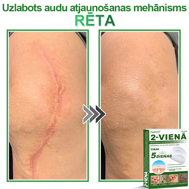 👍 𝐇𝐮𝐝𝐫𝐨𝐬® 𝟐-𝐯-𝟏 𝐡𝐢𝐝𝐫𝐨𝐤𝐨𝐥𝐨ī𝐝𝐢 𝐩𝐥ā𝐤𝐬𝐭𝐞𝐫𝐢 𝐚𝐫 𝐦𝐢𝐤𝐫𝐨𝐚𝐝𝐚𝐭𝐢ņā𝐦 | Ī𝐩𝐚š𝐢 𝐢𝐳𝐬𝐭𝐫ā𝐝ā𝐭𝐢 𝐢𝐳𝐯𝐢𝐫𝐳ī𝐭𝐮 𝐝𝐳𝐢𝐦𝐮𝐦𝐳ī𝐦𝐣𝐮, 𝐚𝐤𝐧𝐞𝐬, 𝐩𝐥𝐚𝐤𝐚𝐧𝐨 𝐤ā𝐫𝐩𝐮 𝐮𝐧 ā𝐝𝐚𝐬 𝐯𝐞𝐢𝐝𝐨𝐣𝐮𝐦𝐮 𝐧𝐨ņ𝐞𝐦š𝐚𝐧𝐚𝐢 | 𝟏𝟒𝟒 𝐠𝐚𝐛𝐚𝐥𝐮 𝐢𝐞𝐩𝐚𝐤𝐨𝐣𝐮𝐦𝐬