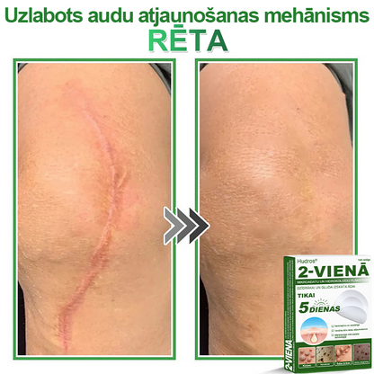 👍 𝐇𝐮𝐝𝐫𝐨𝐬® 𝟐-𝐯-𝟏 𝐡𝐢𝐝𝐫𝐨𝐤𝐨𝐥𝐨ī𝐝𝐢 𝐩𝐥ā𝐤𝐬𝐭𝐞𝐫𝐢 𝐚𝐫 𝐦𝐢𝐤𝐫𝐨𝐚𝐝𝐚𝐭𝐢ņā𝐦 | Ī𝐩𝐚š𝐢 𝐢𝐳𝐬𝐭𝐫ā𝐝ā𝐭𝐢 𝐢𝐳𝐯𝐢𝐫𝐳ī𝐭𝐮 𝐝𝐳𝐢𝐦𝐮𝐦𝐳ī𝐦𝐣𝐮, 𝐚𝐤𝐧𝐞𝐬, 𝐩𝐥𝐚𝐤𝐚𝐧𝐨 𝐤ā𝐫𝐩𝐮 𝐮𝐧 ā𝐝𝐚𝐬 𝐯𝐞𝐢𝐝𝐨𝐣𝐮𝐦𝐮 𝐧𝐨ņ𝐞𝐦š𝐚𝐧𝐚𝐢 | 𝟏𝟒𝟒 𝐠𝐚𝐛𝐚𝐥𝐮 𝐢𝐞𝐩𝐚𝐤𝐨𝐣𝐮𝐦𝐬