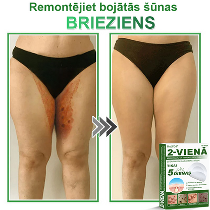 👍 𝐇𝐮𝐝𝐫𝐨𝐬® 𝟐-𝐯-𝟏 𝐡𝐢𝐝𝐫𝐨𝐤𝐨𝐥𝐨ī𝐝𝐢 𝐩𝐥ā𝐤𝐬𝐭𝐞𝐫𝐢 𝐚𝐫 𝐦𝐢𝐤𝐫𝐨𝐚𝐝𝐚𝐭𝐢ņā𝐦 | Ī𝐩𝐚š𝐢 𝐢𝐳𝐬𝐭𝐫ā𝐝ā𝐭𝐢 𝐢𝐳𝐯𝐢𝐫𝐳ī𝐭𝐮 𝐝𝐳𝐢𝐦𝐮𝐦𝐳ī𝐦𝐣𝐮, 𝐚𝐤𝐧𝐞𝐬, 𝐩𝐥𝐚𝐤𝐚𝐧𝐨 𝐤ā𝐫𝐩𝐮 𝐮𝐧 ā𝐝𝐚𝐬 𝐯𝐞𝐢𝐝𝐨𝐣𝐮𝐦𝐮 𝐧𝐨ņ𝐞𝐦š𝐚𝐧𝐚𝐢 | 𝟏𝟒𝟒 𝐠𝐚𝐛𝐚𝐥𝐮 𝐢𝐞𝐩𝐚𝐤𝐨𝐣𝐮𝐦𝐬